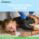 Грязелечение кожных заболеваний